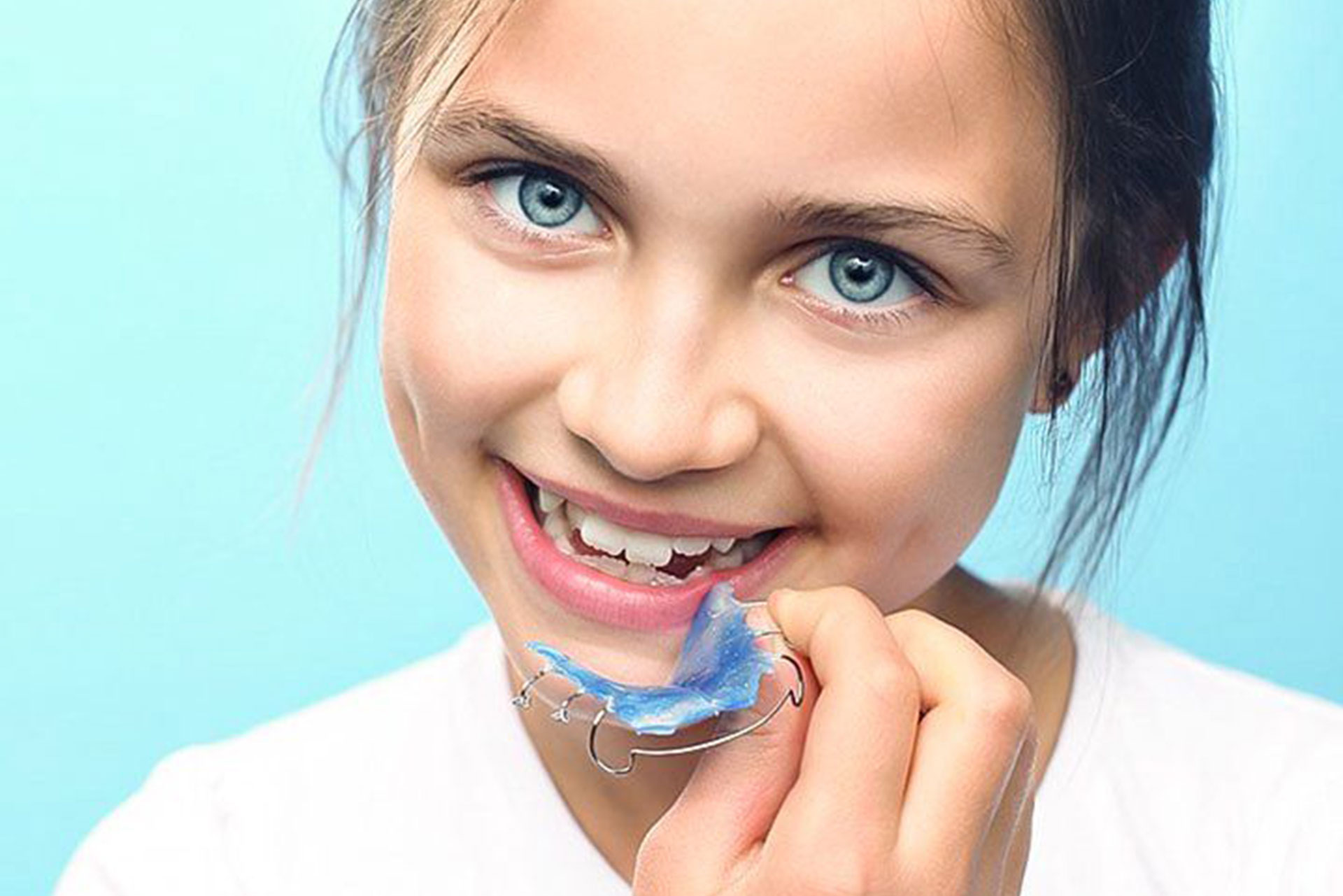 aparelho-ortodôntico-para-crianças-0ab998a3-1920w
